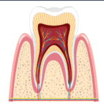 اسباب حدوث خراج الاسنان