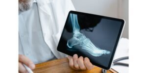 هل يوجد طرق جديدة لعلاج أمراض العظام والمفاصل؟