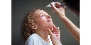 احمرار العين والتهابها