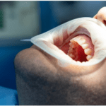 الأعراض المشتركة لمرض اللثة