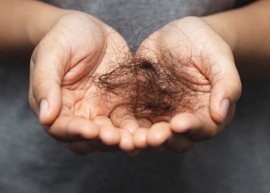 زراعة الشعر كل ماتريد معرفته عنها