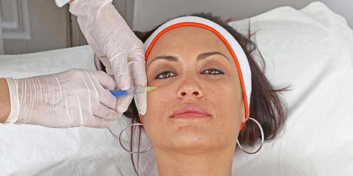  الانتفاخات تحت العينين 