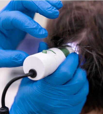 عيادات زراعة الشعر