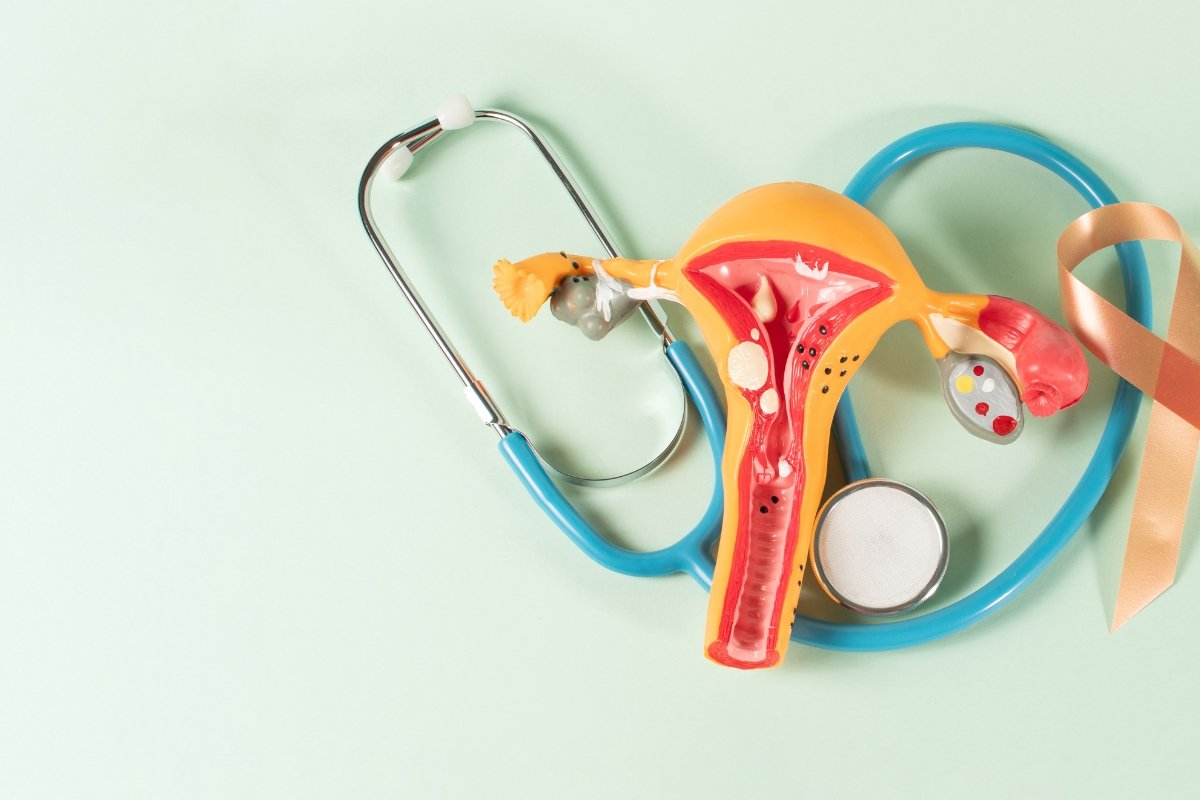 سرطان الرحم