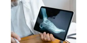 هل يوجد طرق جديدة لعلاج أمراض العظام والمفاصل؟