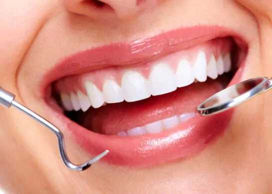 تجميل الأسنان | فوائد وانواع وكامل المعلومات التي تحتاجها