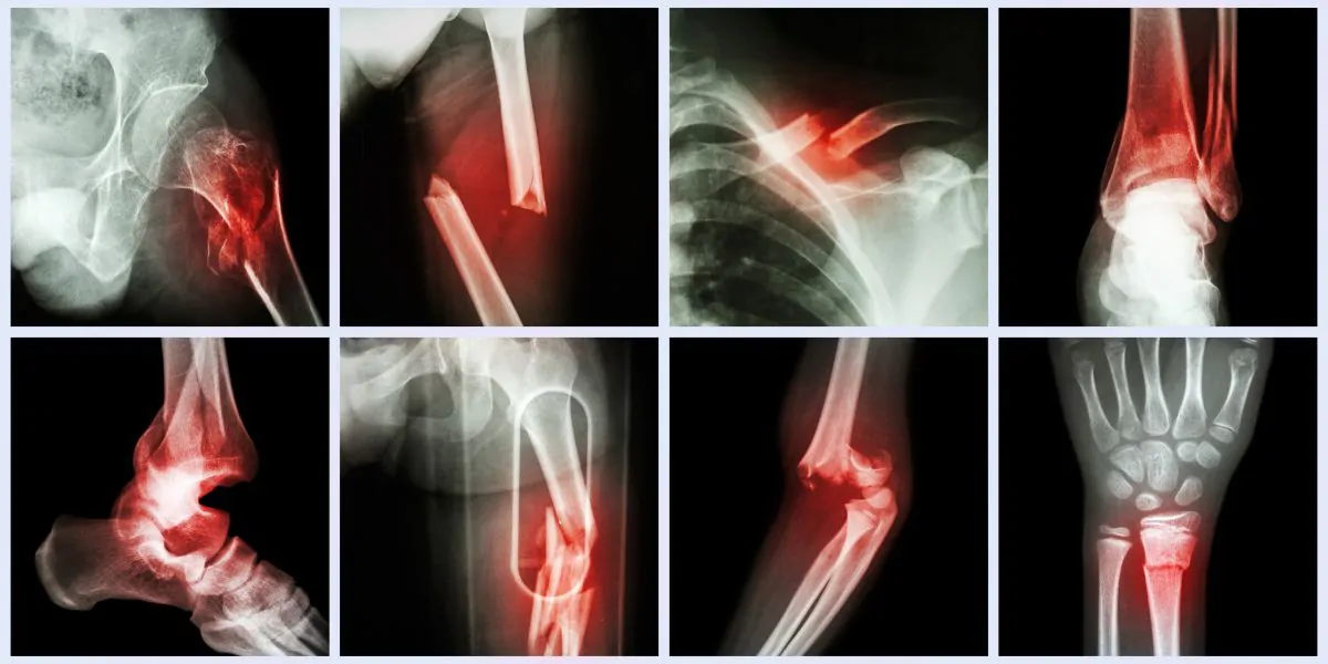 جراحة القدم والكاحل ..