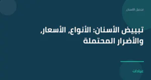 صورة توضيحية لمقال تبييض الأسنان: الأنواع، الأسعار، والأضرار المحتملة ضمن قسم تجميل الأسنان