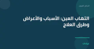 صورة توضيحية لمقال التهاب العين: الأسباب والأعراض وطرق العلاج ضمن قسم أمراض العيون