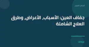 صورة توضيحية لمقال جفاف العين: الأسباب، الأعراض، وطرق العلاج الشاملة ضمن قسم أمراض العيون