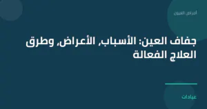 صورة توضيحية لمقال جفاف العين: الأسباب، الأعراض، وطرق العلاج الفعالة ضمن قسم أمراض العيون