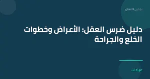 صورة توضيحية لمقال دليل ضرس العقل: الأعراض وخطوات الخلع والجراحة ضمن قسم تجميل الأسنان