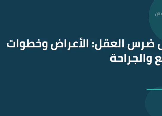 دليل ضرس العقل: الأعراض وخطوات الخلع والجراحة