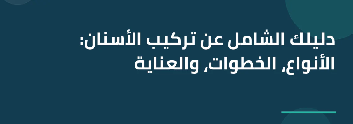 دليلك الشامل عن تركيب الأسنان: الأنواع، الخطوات، والعناية