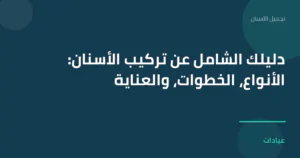صورة توضيحية لمقال دليلك الشامل عن تركيب الأسنان: الأنواع، الخطوات، والعناية ضمن قسم تجميل الأسنان