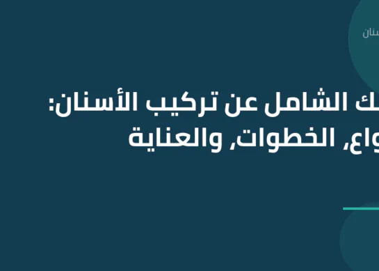 دليلك الشامل عن تركيب الأسنان: الأنواع، الخطوات، والعناية