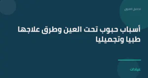 صورة توضيحية لمقال أسباب حبوب تحت العين وطرق علاجها طبياً وتجميلياً ضمن قسم تجميل العيون