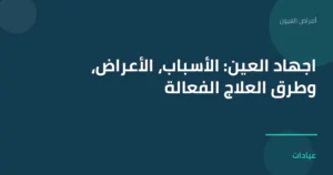 صورة توضيحية لمقال اجهاد العين: الأسباب، الأعراض، وطرق العلاج الفعالة ضمن قسم أمراض العيون