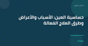 صورة توضيحية لمقال حساسية العين: الأسباب والأعراض وطرق العلاج الفعالة ضمن قسم أمراض العيون