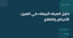 صورة توضيحية لمقال دليل المياه البيضاء في العين: الأعراض والعلاج ضمن قسم أمراض العيون