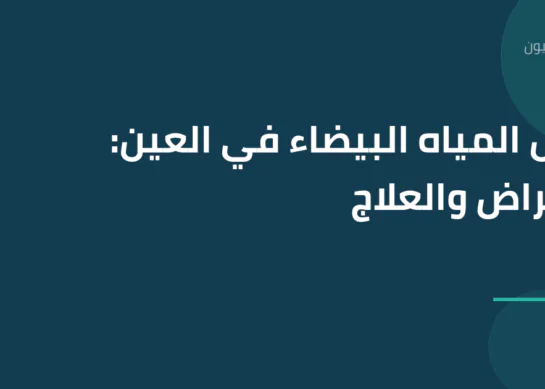 دليل المياه البيضاء في العين: الأعراض والعلاج