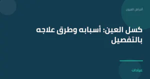 صورة توضيحية لمقال كسل العين: أسبابه وطرق علاجه بالتفصيل ضمن قسم أمراض العيون